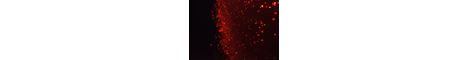 ZacBridging banner